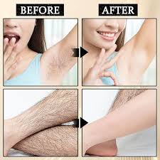 ✨ Body Care – Hair Removal Cream